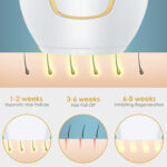 ⁦Hair Removal IPL Epilator for Women 500000 Flashes Epilator Hair Removal Device Shaving Machine Facial Epilator Women's Shaver⁩ - الصورة ⁦4⁩